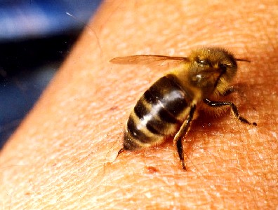 Bee Sting